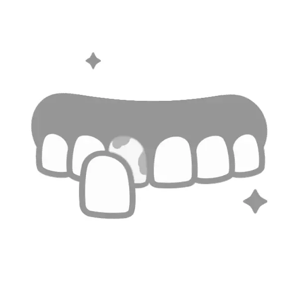 faccette denti