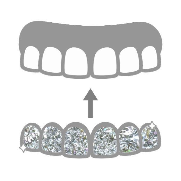grillz denti